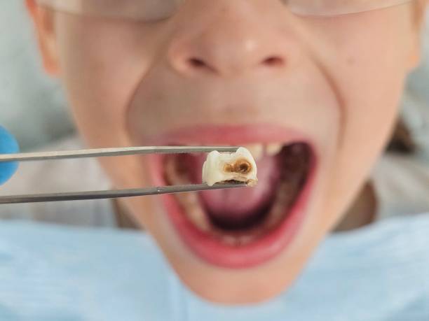 Best Weekend Emergency Dental Services in Benton Harbor, MI