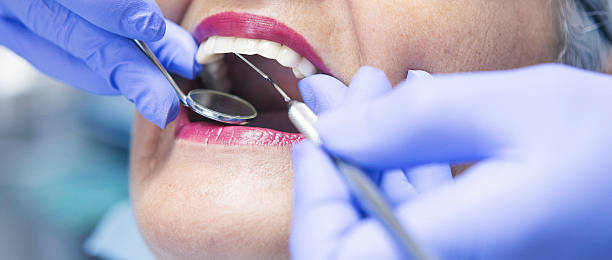 Best Emergency Wisdom Tooth Extraction in Benton Harbor, MI