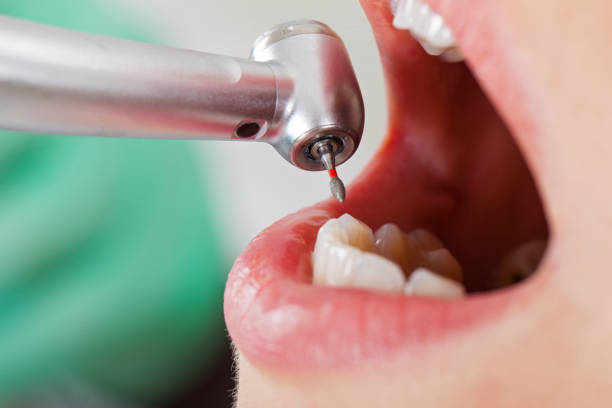 Best Emergency Root Canal Therapy in Benton Harbor, MI